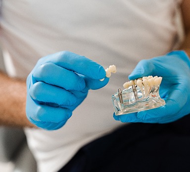 closeup of a model of dental implants