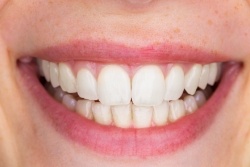 Closeup of smile with straight white teeth