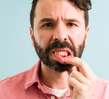 man with gum disease in Itasca, IL pulling down lip