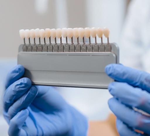 Dentist holding shades of veneers with blue gloves